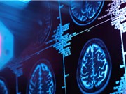 Dự đoán nguy cơ mắc bệnh dựa trên tuổi sinh học của các cơ quan trong cơ thể